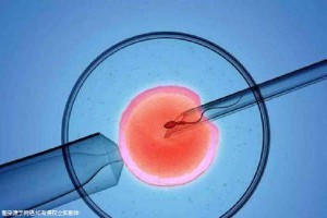 42岁二胎妈妈